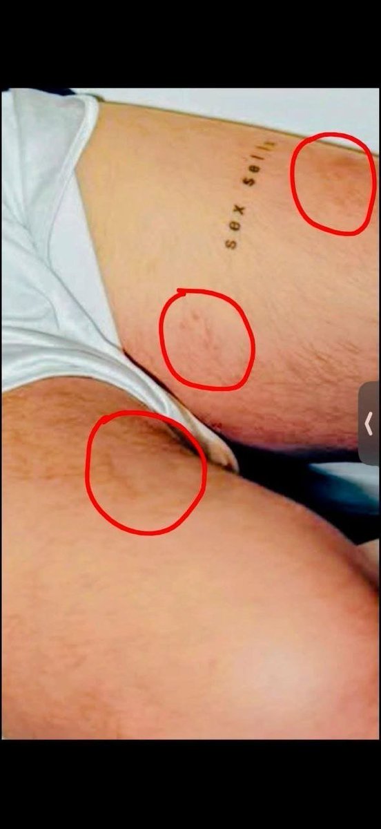 Geneticbaby_'s tweet photo. Como olvidar esos mosquitos texanos https://t.co/6sXlXBYH03