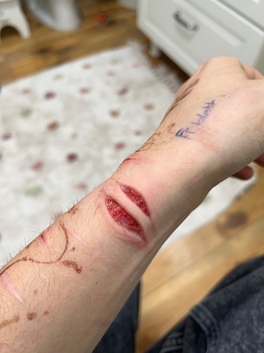 Mybigaaahballs's tweet photo. It got taken down so here we go again. ITS FAKE SFX MAKE UP MADE WITH AI FOR HALLOWEEN. #slittwt #shtwt #sh #beanstwt https://t.co/6AgNJL6jam