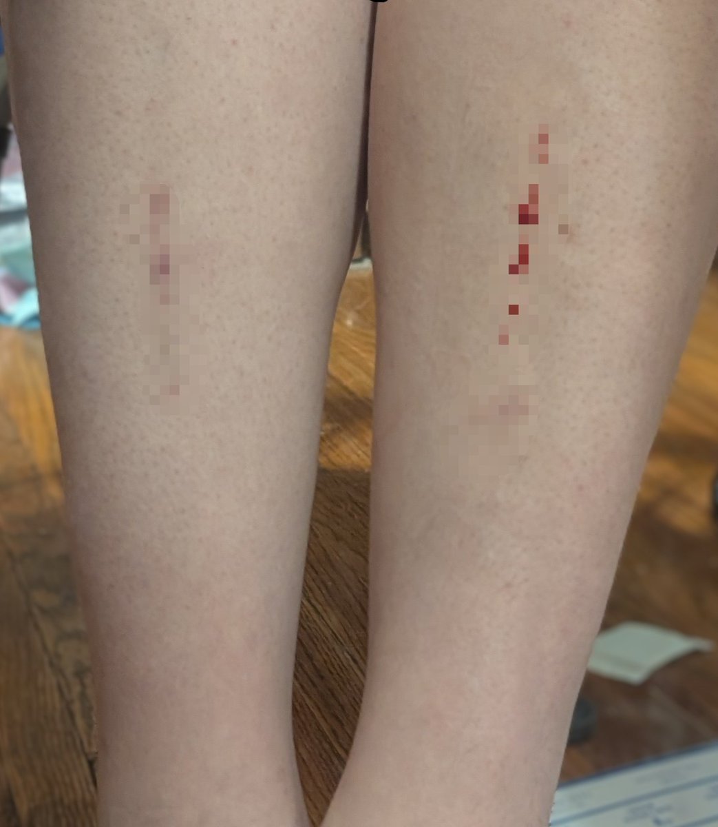 WillowTweez's tweet photo. I don't know about this shaving shit. I keep taking skin off my shins. Lol

Blurred because idk. Blood. https://t.co/Fl5pKTCyyD