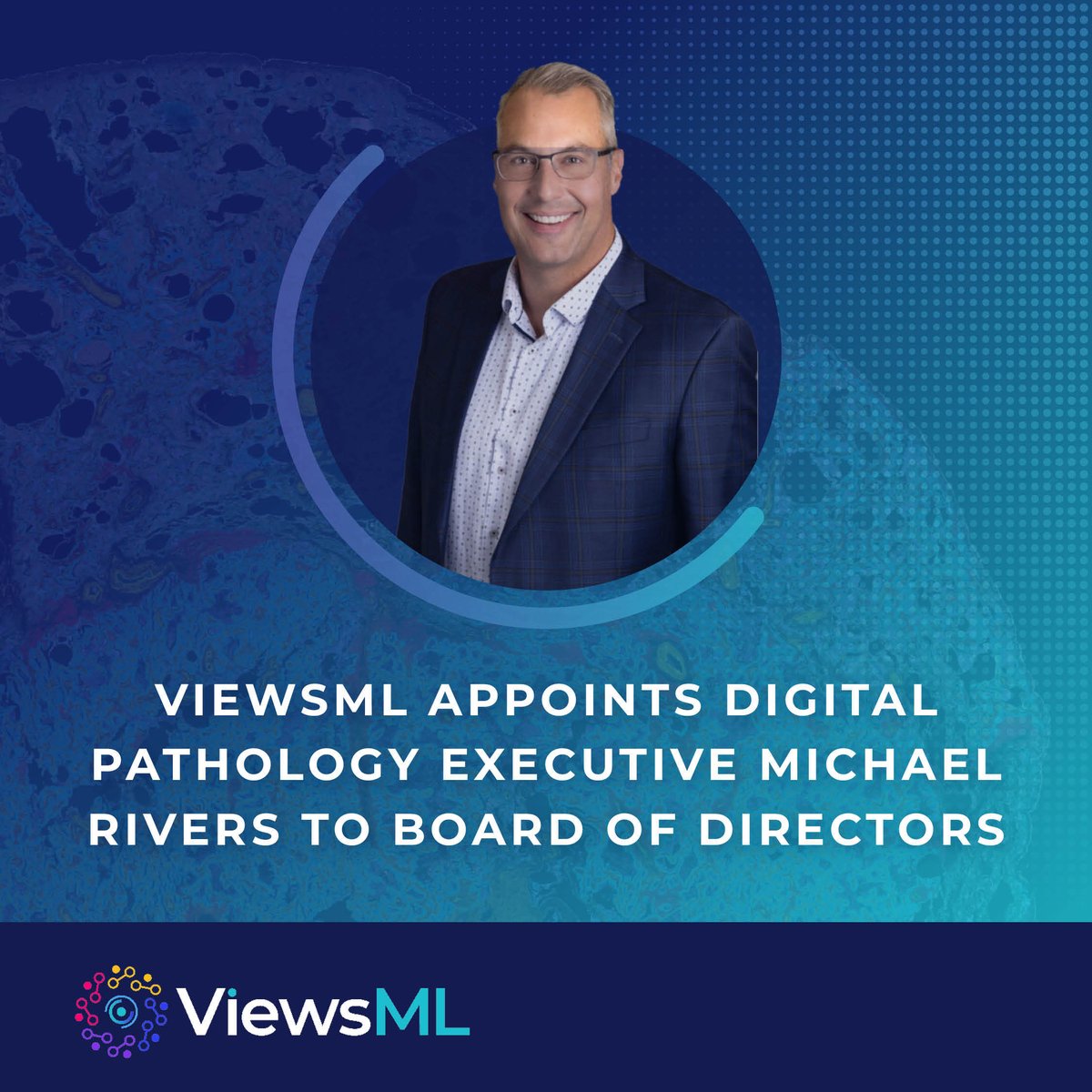 viewsML's tweet photo. Welcome Michael Rivers to our BoD! He brings 20+ years of experience leading the commercialization of global diagnostic &amp; #digitalpathology portfolios, including advancing AI-enabled technologies from development to regulatory clearance &amp; market adoption. https://t.co/biN55PjkOq https://t.co/rod1E7sHvR