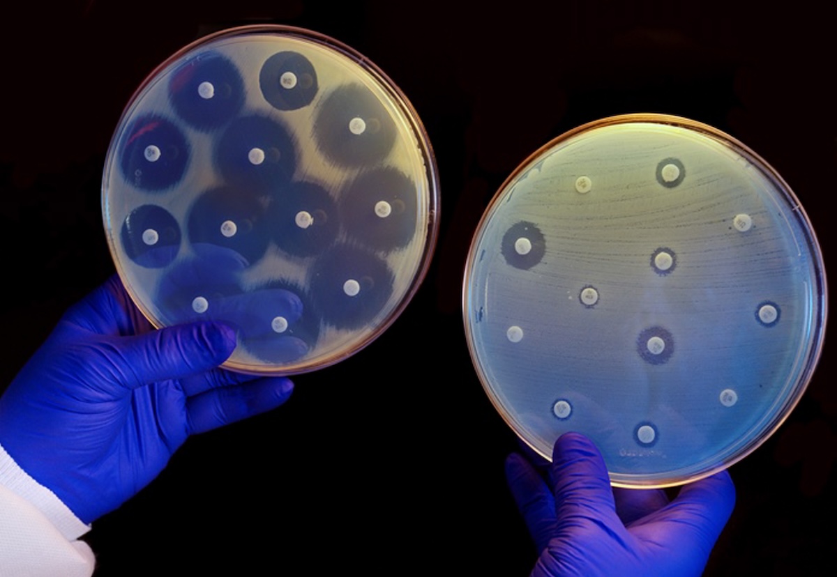 Rapporteur_FR's tweet photo. Lutte contre la résistance aux antimicrobiens : L’Europe risque de ne pas atteindre ses objectifs: La consommation d'antibiotiques en Autriche augmente au fil du temps, a déclaré un responsable 

The post Lutte contre la résistance aux antimicrobiens : L’Europe… dlvr.​it/TVjZsL https://t.co/aShUHPNsN7