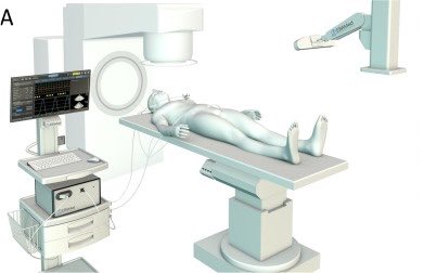 to_be_elizabeth's tweet photo. 📌 Integration of an echocardiographic motion-management system into photon-based stereotactic arrhythmia radioablation planning

🔗 https://t.co/DqgnUJXGDE
@OncoAlert #OncoAlertAF @UniHeidelberg 

Happy to share our latest research⚡️🫀

☢️ Photon-based #STAR planning with an ultrasound probe is feasible. 🔹D0.035 cm3 to the probe below 1 Gy with apical/ parasternal probe placement. 🔹No significant differences in target dose-volume metrics with spared probe. 🔹All dose guidance parameters within clinically acceptable limits. 🔹Results support further investigation of ultrasound-based motion management.