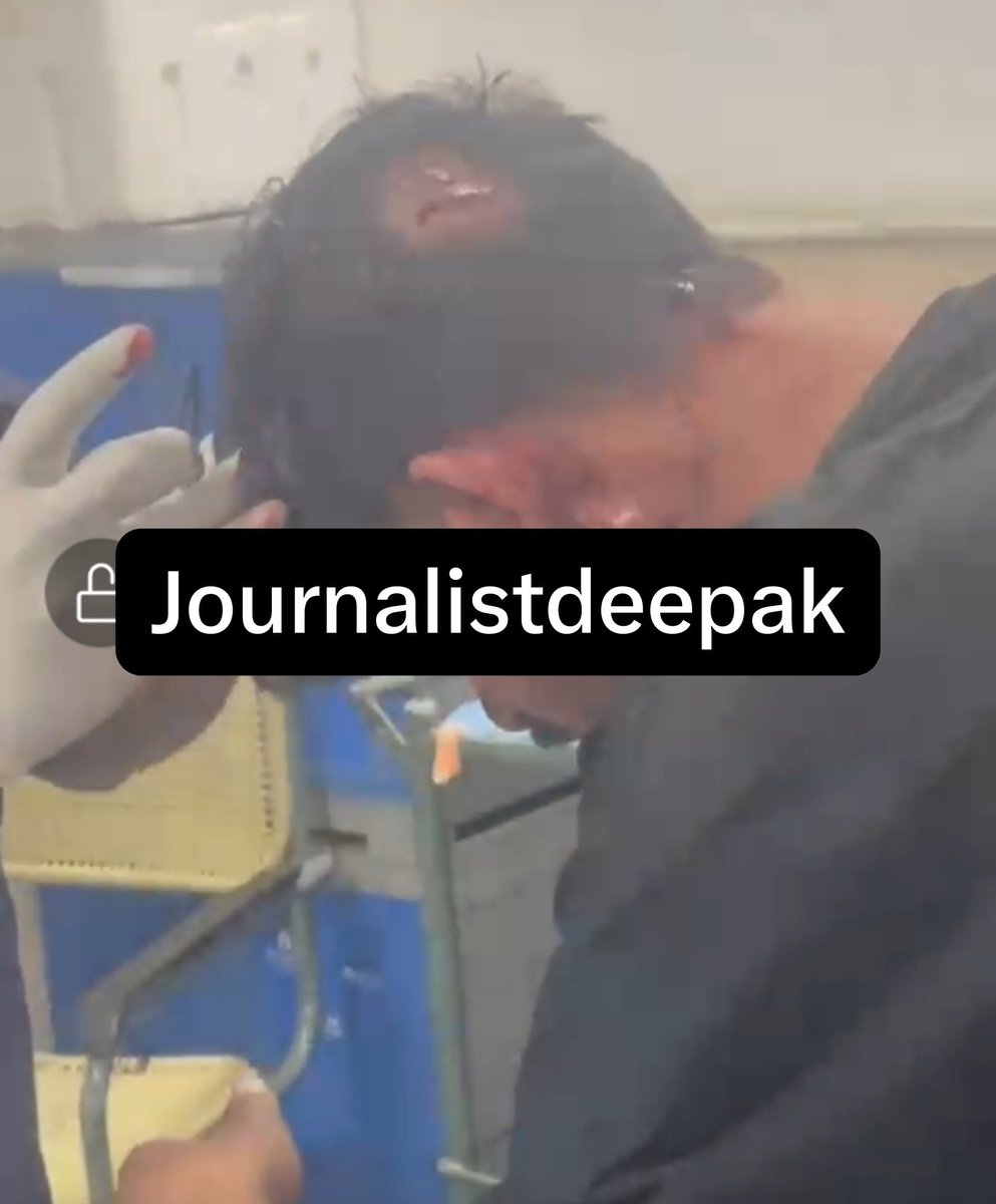newswithdeepak's tweet photo. 👉रोहिणी जिला में अपराधियों के हौसले बुलंद  कानून का कोई खौफ नहीं बेधड़क दे रहे है अपराधों को अंजाम।
👉 रोहिणी जिला के अमन विहार के अंतर्गत
रोहिणी सेक्टर 20 में युवक के घर पर  20 से 30 बदमाशों ने किया पथराव ,युवक ने लगाई पुलिस से गुहार युवक का आरोप पुलिस नहीं सुन रही युवक की गुहार।
👉विजय विहार के इलाके में बीती रात करीब 10:05 के आस पास युवक के साथ हुई स्नेचिंग।
👉हमेशा बड़ा हादसा होने के बाद ही क्यों जागती है पुलिस।
👉अपराधियों में क्या कानून डर खत्म हो गया है।
👉रोहिणी जिला में तेजी से बढ़ रही है अपराधिक वारदाते।
👉पुलिस थानों में नहीं होती है फरियादी की सुनवाई।
👉 कई जगहों पर बीट बूथ से नदारद रहते है पुलिसकर्मी। 
 @CPDelhi
@DelhiPolice @Vijay_Singh_IPS @dcprohinidelhi @LtGovDelhi @cmodelhi @rekhagupta #delhipolice #dpupdates #hellopolicestation #amanviharpolicestation #shoamanvihar #dcprohini 
#crimenews #cctvfootage