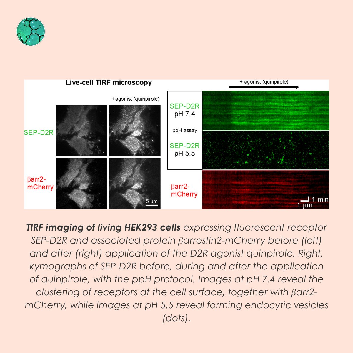 Fr_BioImaging's tweet photo. [PUBLI] How do membrane polyunsaturated fatty acids impact dopamine receptor trafficking?🧠

Researchers from the IINS investigated the role of PUFAs, present in brain cell membranes, in the trafficking of the dopamine D2 receptor.

Read our article👉 https://t.co/Db5Maw4DVu https://t.co/FylWaAX2ZQ