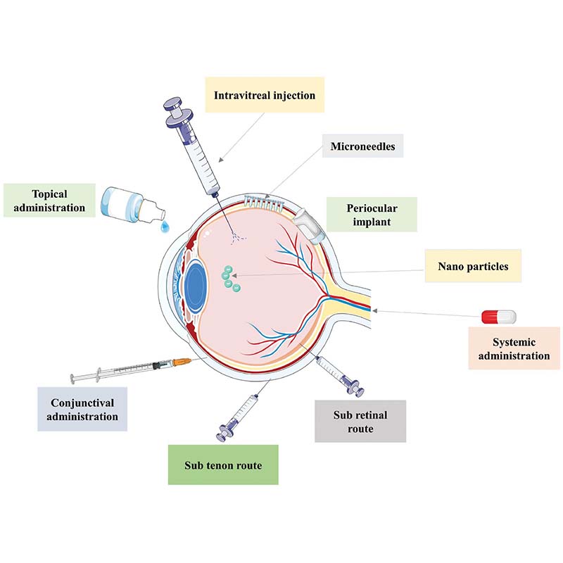 JournalBio's tweet photo. Ocular inserts, drug‑loaded lenses, and microneedles overcome drainage and low bioavailability, delivering sustained, precise therapies with nanotech and smart polymers. #Ophthalmology #DrugDelivery @AmityUni
#BIOI #OpenAccess: https://t.co/hbXhNPJymO https://t.co/6dSqui8sKK