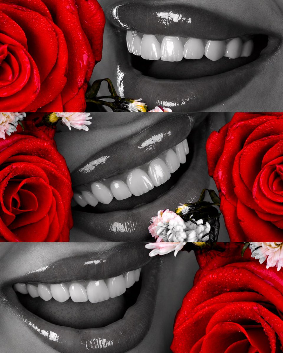 drhalmuhaisen's tweet photo. ابتسامة مثل الوردة 🌹
#Dentistry #DentalCare #Dentist #SmileMakeover #CosmeticDentistry #DentalClinic #OralHealth #HealthySmile #PerfectSmile #DentalAesthetics #Veneers #TeethWhitening #DentalImplants #AmmanDentist #JordanDentist #Amman #Jordan #SmileDesign #DigitalSmileDesign https://t.co/YkaunarRsN