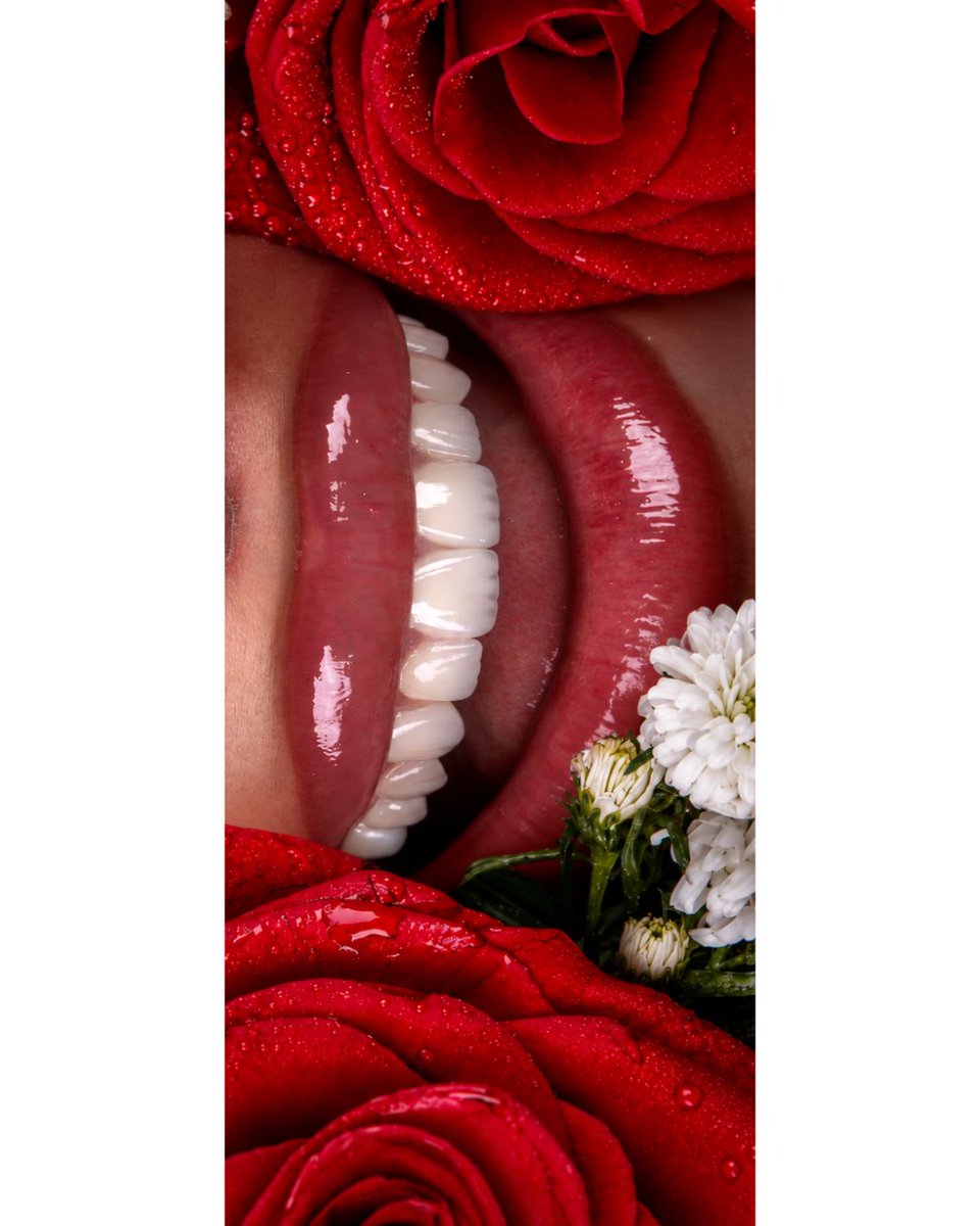 drhalmuhaisen's tweet photo. ابتسامة مثل الوردة 🌹
#Dentistry #DentalCare #Dentist #SmileMakeover #CosmeticDentistry #DentalClinic #OralHealth #HealthySmile #PerfectSmile #DentalAesthetics #Veneers #TeethWhitening #DentalImplants #AmmanDentist #JordanDentist #Amman #Jordan #SmileDesign #DigitalSmileDesign https://t.co/YkaunarRsN