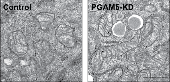 AJsmith231's tweet photo. The result: Increased phosphorylation of cristae forming complexes in PGAM5 knockdown cells leads to denser cristae, more MIB assembly, fewer ATP synthase dimers, faster growth, and greater spare respiratory capacity.

Full preprint: https://t.co/sRQqqUEPqb https://t.co/gUzXkTHBmZ