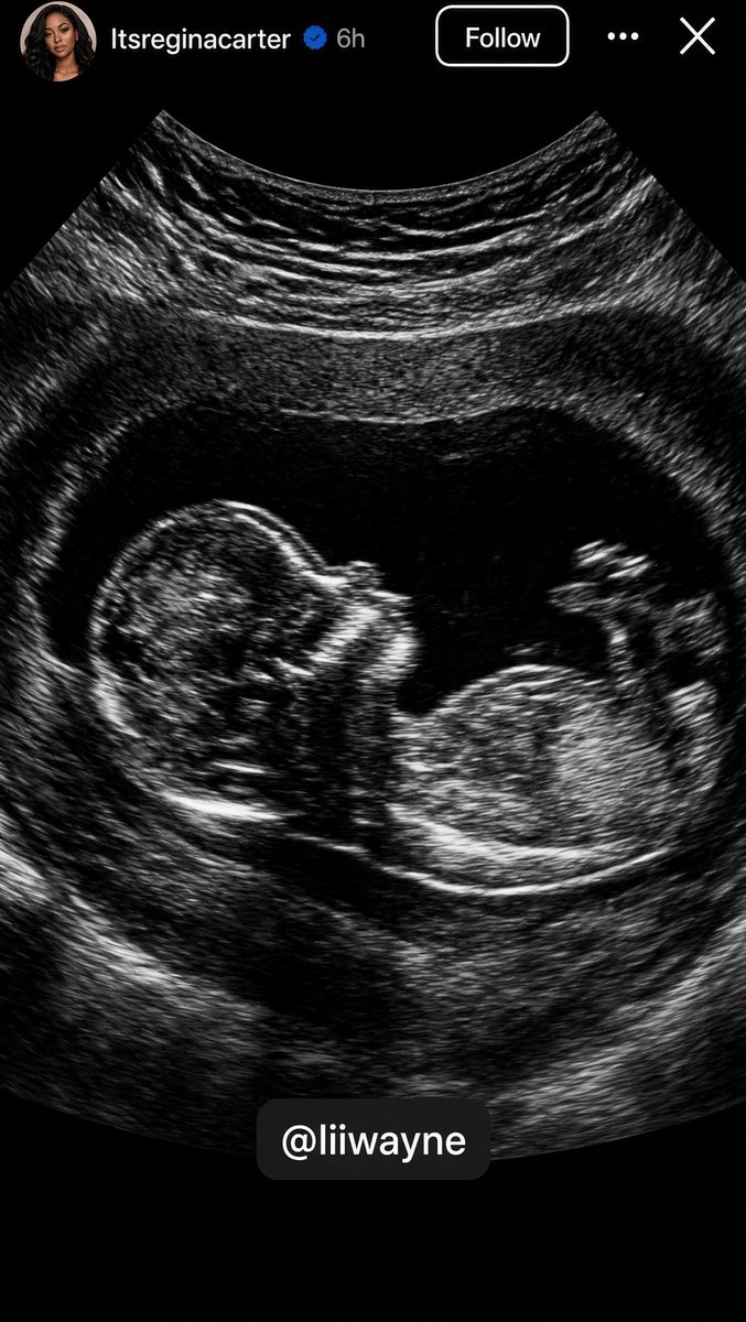 FAFObyCunt's tweet photo. Lil Wayne’s daughter Regina Carter just posted on her Instagram story that her dad is expecting a baby with Madi Cannon. https://t.co/aCfYj9fczs