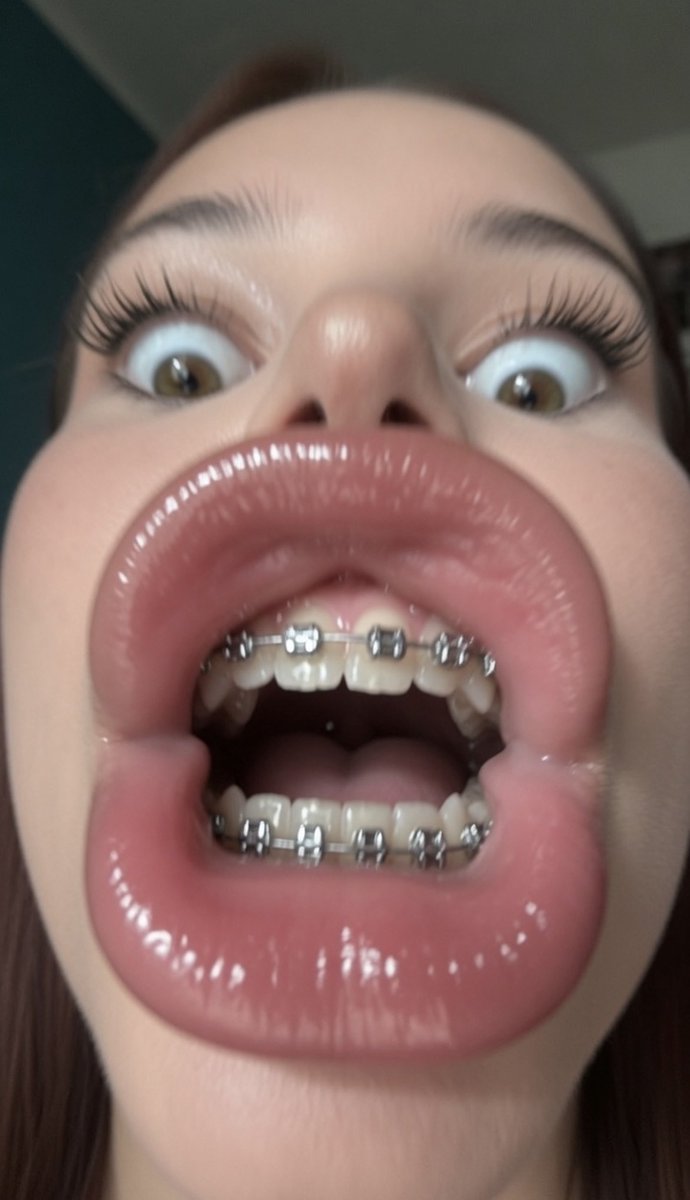 LipQueenCity's tweet photo. You Lip Models Need To Up Your Game &amp; Match Shorty Energy, We Want Them Silly Faces With Wide Eyes, Don’t Be Afraid To Br Goofy &amp; Weird Because That Shit Makes Us Gooners Harder &amp; Makes Us Wanna Spend More Money On Yall Lips &amp; Faces 😵‍💫🥜🧱🤤 https://t.co/faLSzjcmdc