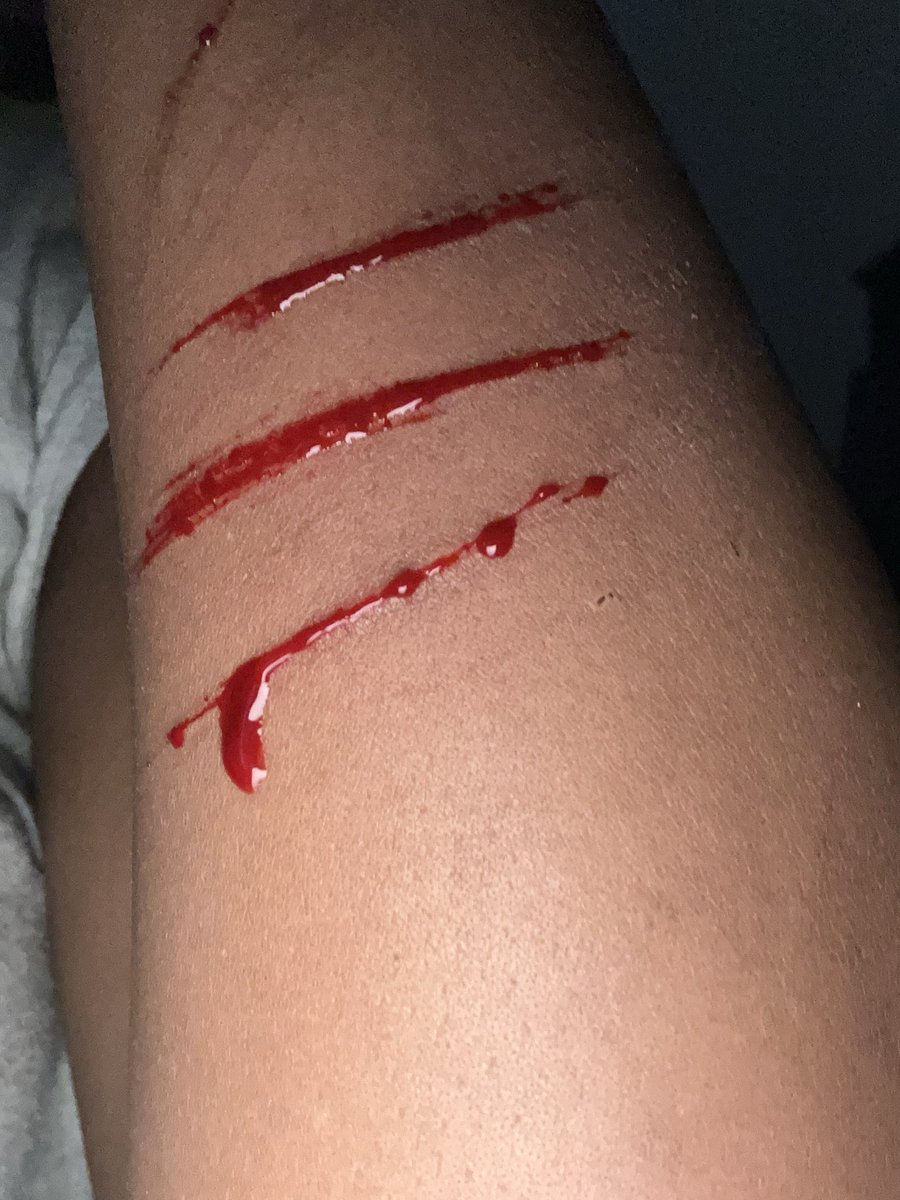 notsamscore's tweet photo. ai #sfxmakeup (still cat scratches) :( https://t.co/1Xmiu3Rl7V