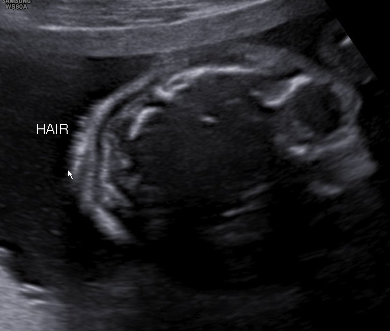 CaliAggy's tweet photo. can't believe I'm bringing another Dominican and Haitian boy to this crazy world ✝️👶🏽
Our baby is looking soooo handsome already! With a head full of HAIR! God, I'm so ready to meet him M.M 🥹🧡
12.25.26 https://t.co/A6RyRJUF5E