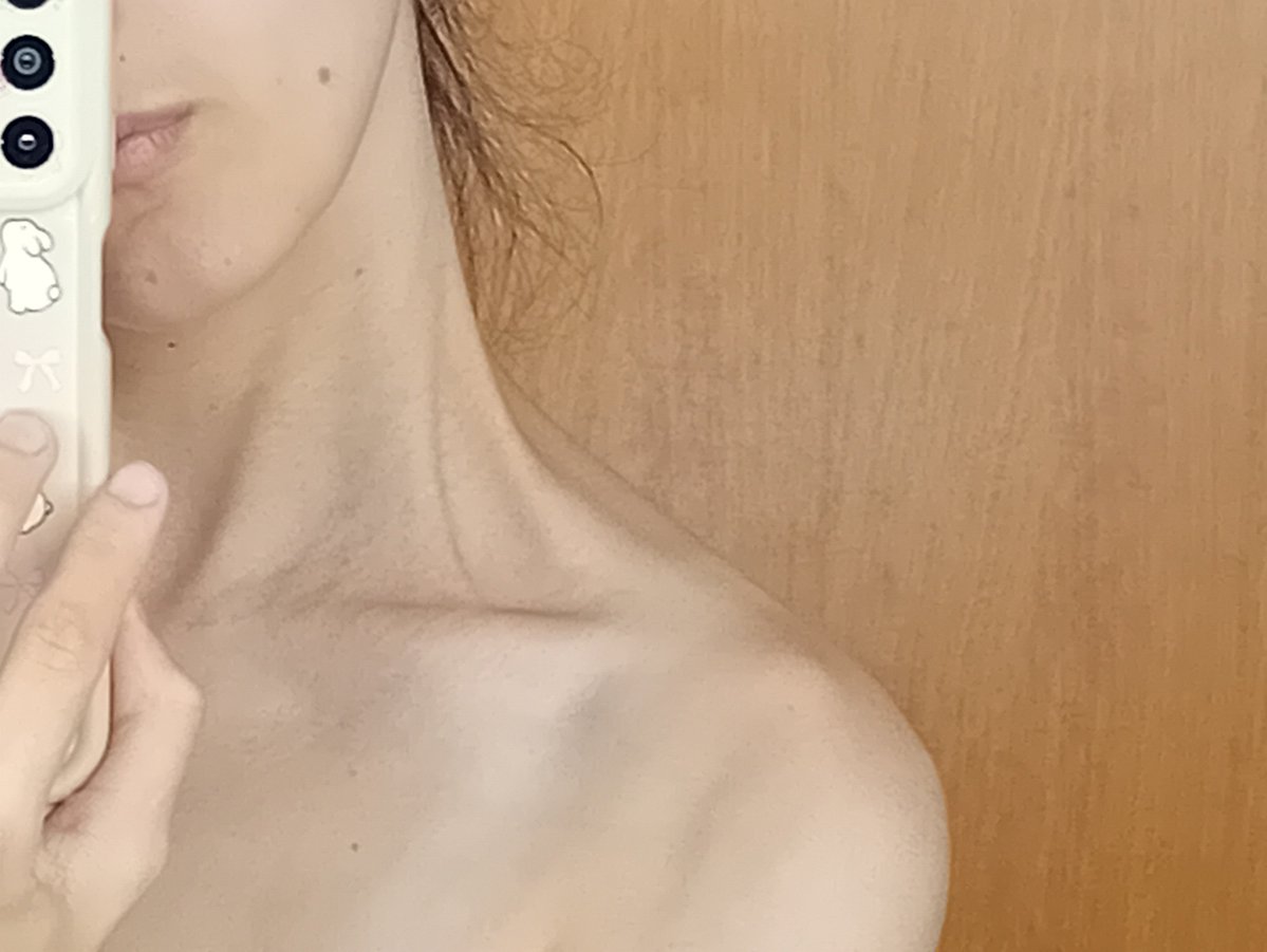 emptykcals49's tweet photo. holy shoulder bones https://t.co/Yd0bnphF0g