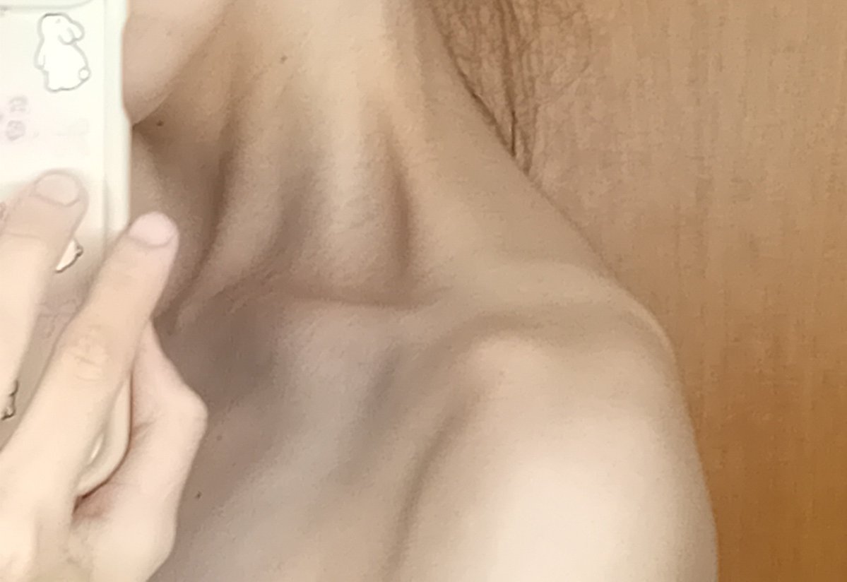emptykcals49's tweet photo. holy shoulder bones https://t.co/Yd0bnphF0g