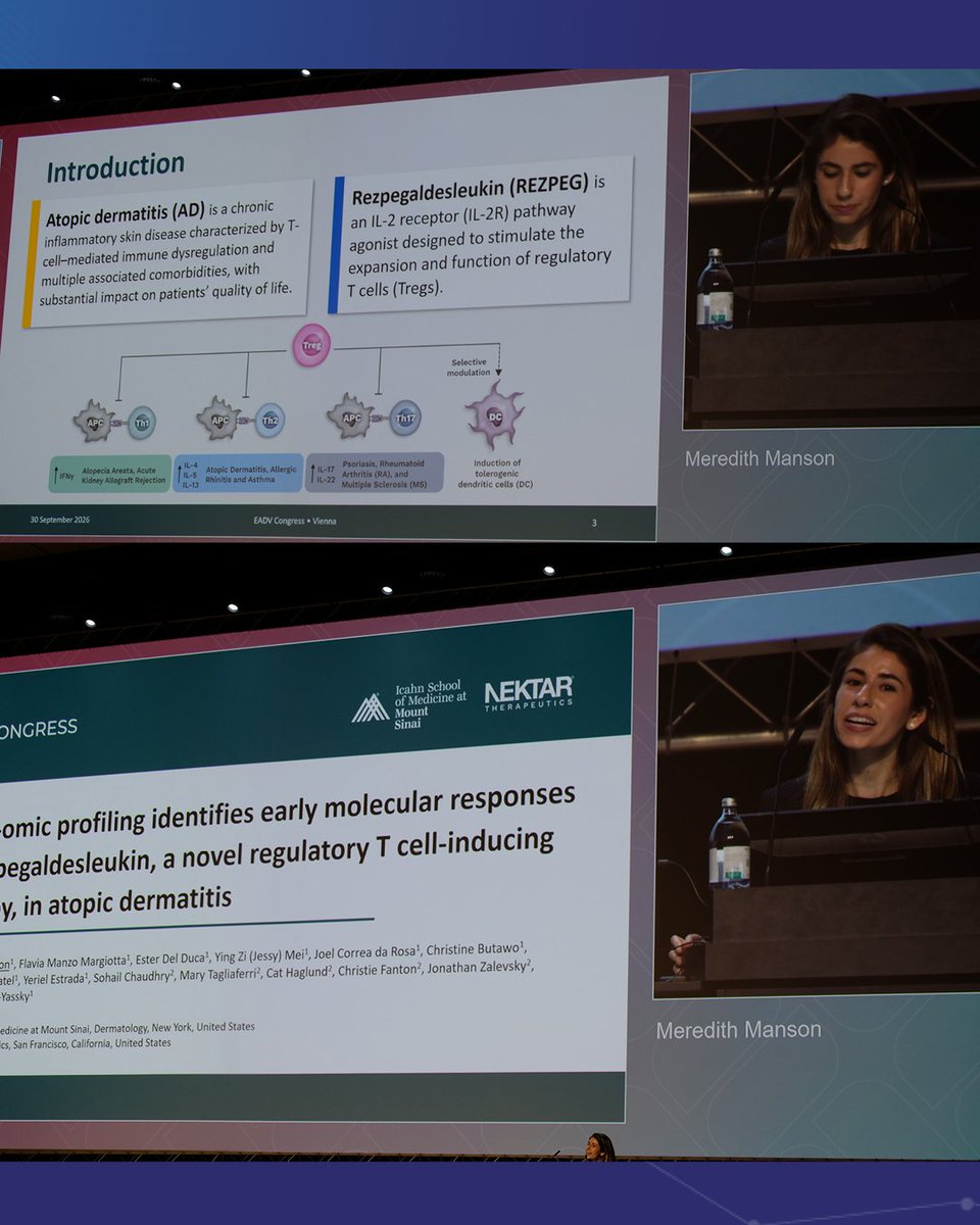 MSHSDerm's tweet photo. 1 of 5(!) of our late breakers, presented by Meredith Manson, med student, EADV Congress 2026 #Vienna— “Multi-omic profiling identifies early molecular responses to rezpegaldesleukin, a novel regulatory T cell-inducing therapy, in atopic dermatitis”@EmmaGuttman @IcahnMountSinai https://t.co/Mplgs4mRsr
