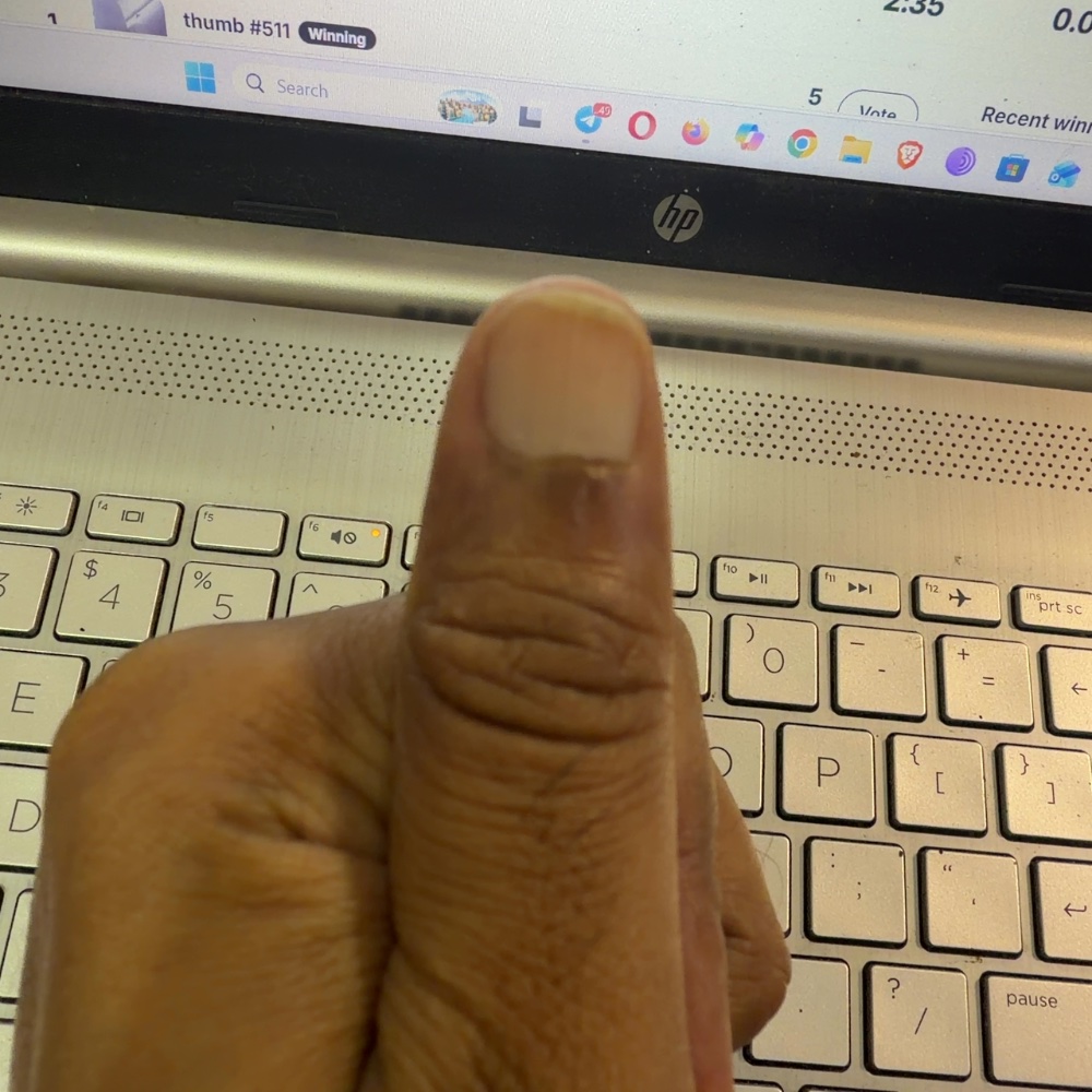 thumbyydotfun's tweet photo. thumb 563 https://t.co/eLbgzwCZPr