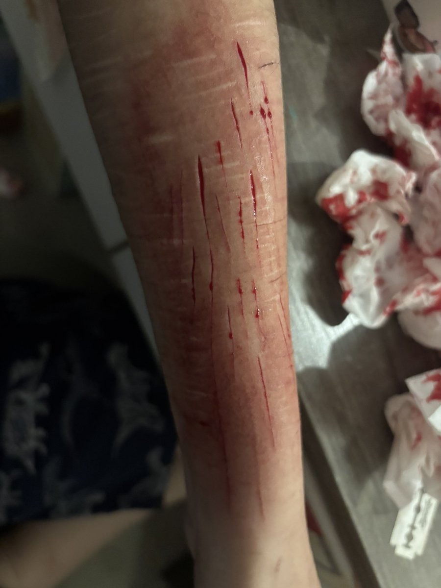 8a7imx's tweet photo. vfx ai generated sfx fake blood makeup 

#shtwt #slittwt #ouchietwt https://t.co/2RGA9IGu80