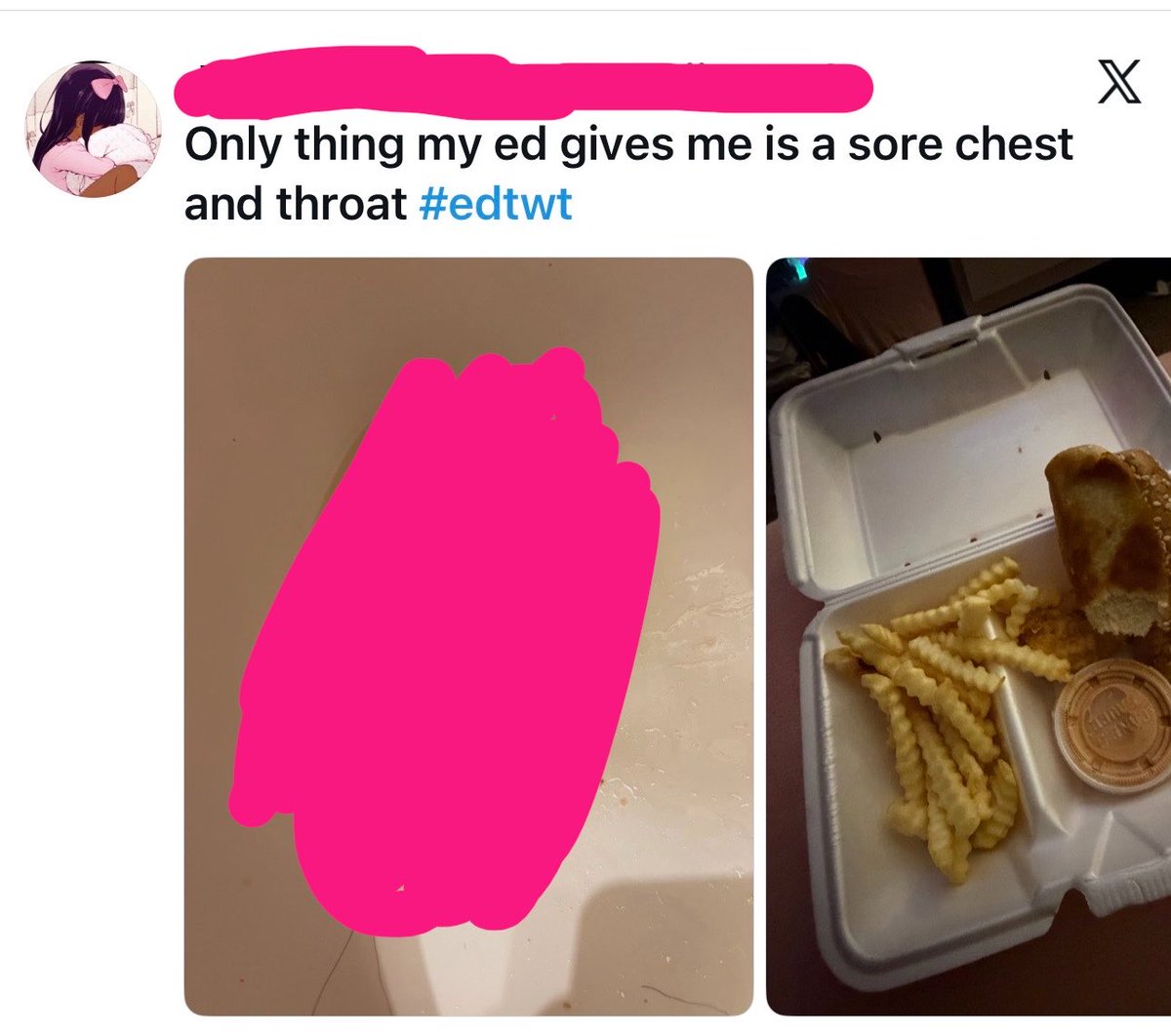 cinnyrella's tweet photo. STOP POSTING UNCENSORED VOMIT PLEASEPLEASEPLEASEPLEASEPLEASE https://t.co/3OOPLllO2l