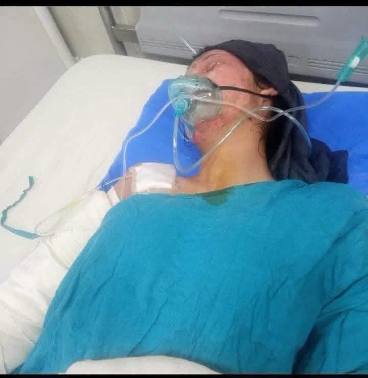 sepaabbasi's tweet photo. قربانی کی لازوال مثال
عائشہ کلیم عباسی نویں جماعت کی سٹوڈنٹ تھی گزشتہ دن مری وین حادثے میں جھلسنے والے بچوں کو نکالنے میں مدد دے رہی تھی اپنی جان کی پرواہ کیے بغیر اور آج اپنی جان اپنے رب کے حضور پیش کر دی
سلام ہے عائشہ آپ اور آپ کے ماں باپ پر https://t.co/JYKXXSoQlQ