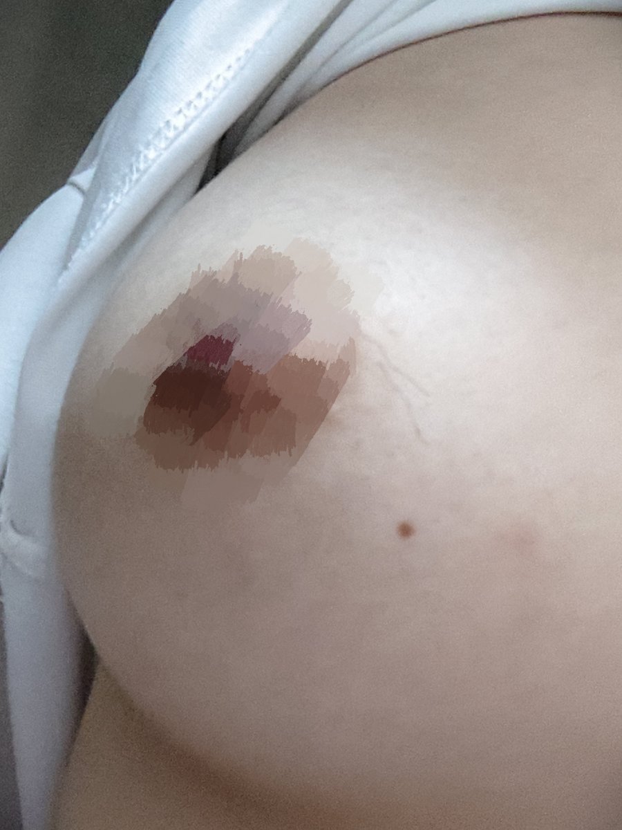 ttgogo8's tweet photo. 这两根毛你就不能长脑壳上吗？ https://t.co/yUa5iPIr0L