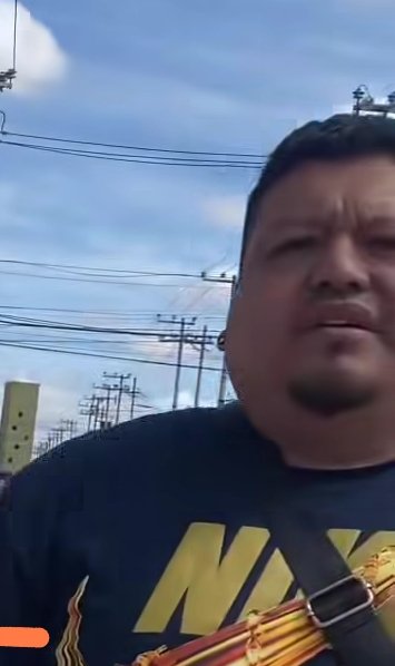 LicAnimalista's tweet photo. #NoticiaCriminal en Sauces 1 en Zumpango, personas permiten peleas de perros, menores de edad observan en el lugar y responsables hasta se burlan cuando les reclaman. @FiscaliaEdomex urge su intervención. @delfinagomeza @CEPANAF @propaem_sma https://t.co/zyV2zoqwr1