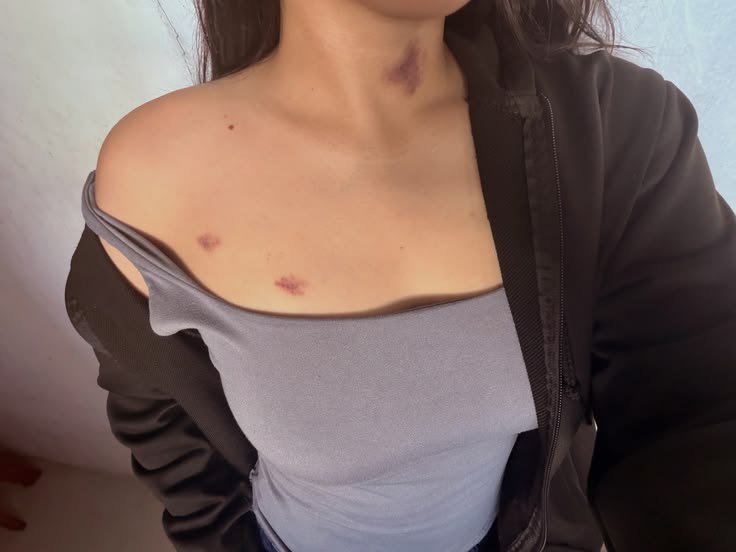 sali4kdm's tweet photo. لما يكون  الزبون الي عندي بحب الرقبة كثيررر 🤤🎀🫦 https://t.co/jumnkGANym