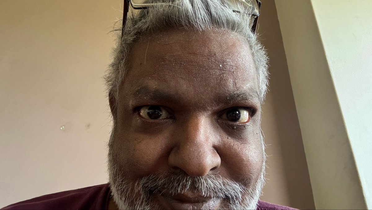 WorldXIX75's tweet photo. Hypnosed clocking world to a collection, patent, copyright and land usage occupation poor settled and drawn in failure.
It is hoped on one to find the way inserts goes. We captured stuck on autocratie of a craving for capitulation. https://t.co/eifBB2jCq4