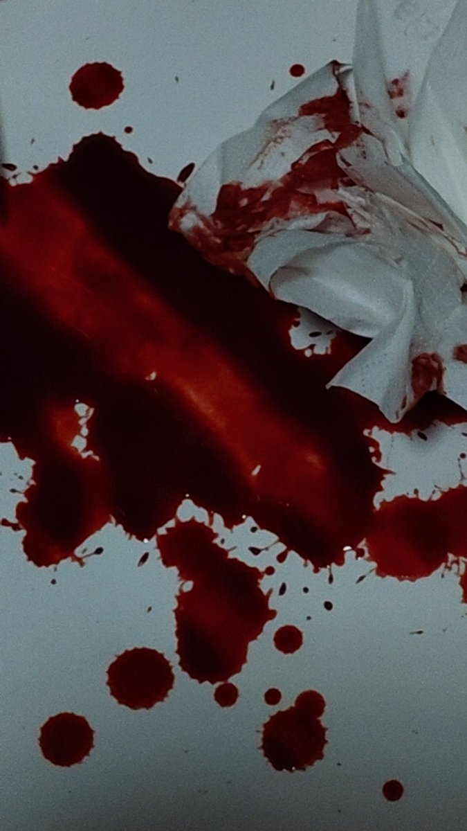 Lingnw1n's tweet photo. fakeblood fakeblood fakeblood https://t.co/vEH0lprJ4s