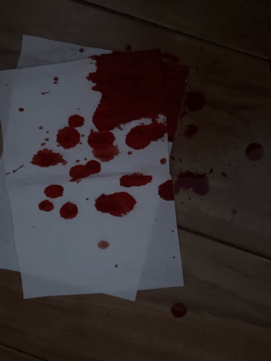 Lingnw1n's tweet photo. fakeblood fakeblood fakeblood https://t.co/vEH0lprJ4s