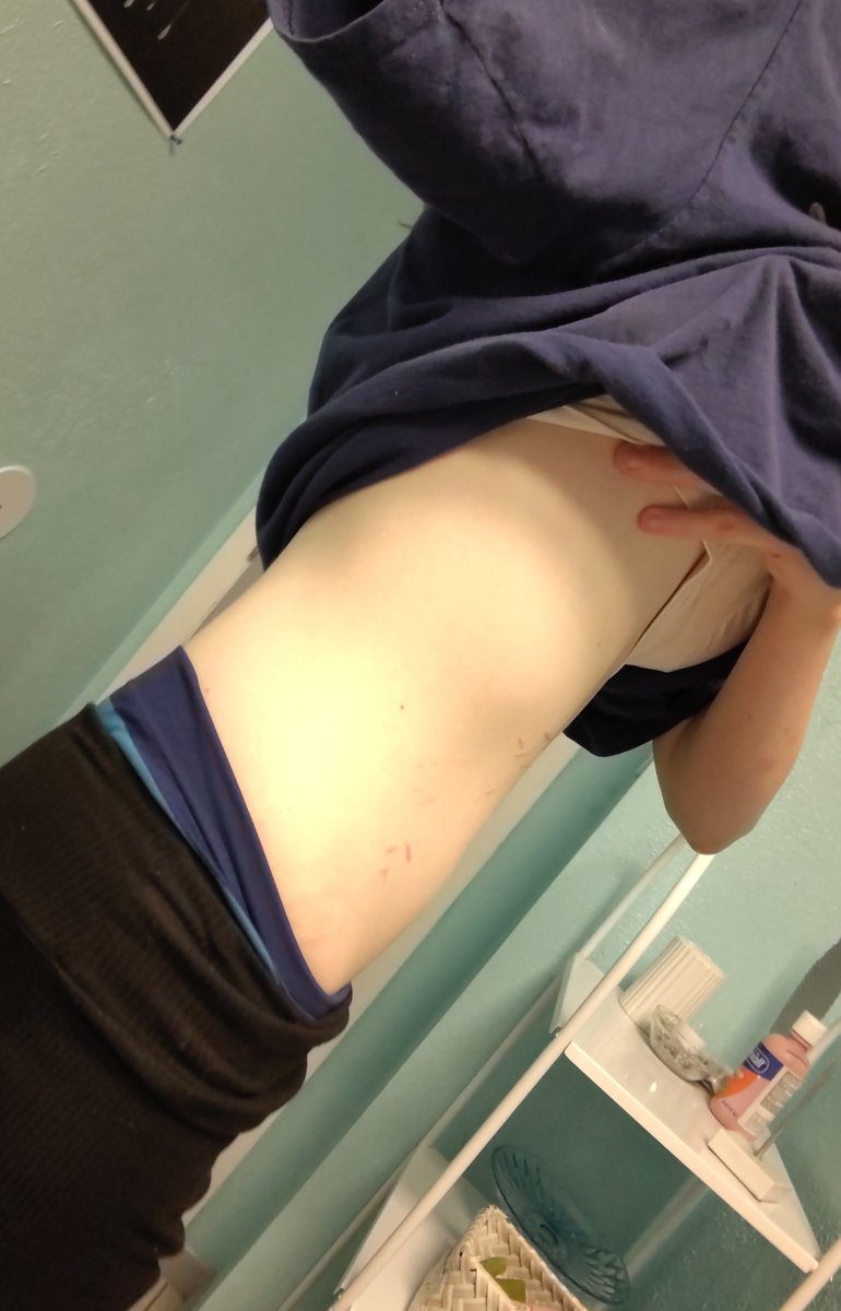Fatal_angel488's tweet photo. #Ed #Edr-twt #moots  #moots #edtwt  #bodycheck 123.6lb today, Bmi 19.4 might be bloated, moot me up? https://t.co/qTUEJRbumB