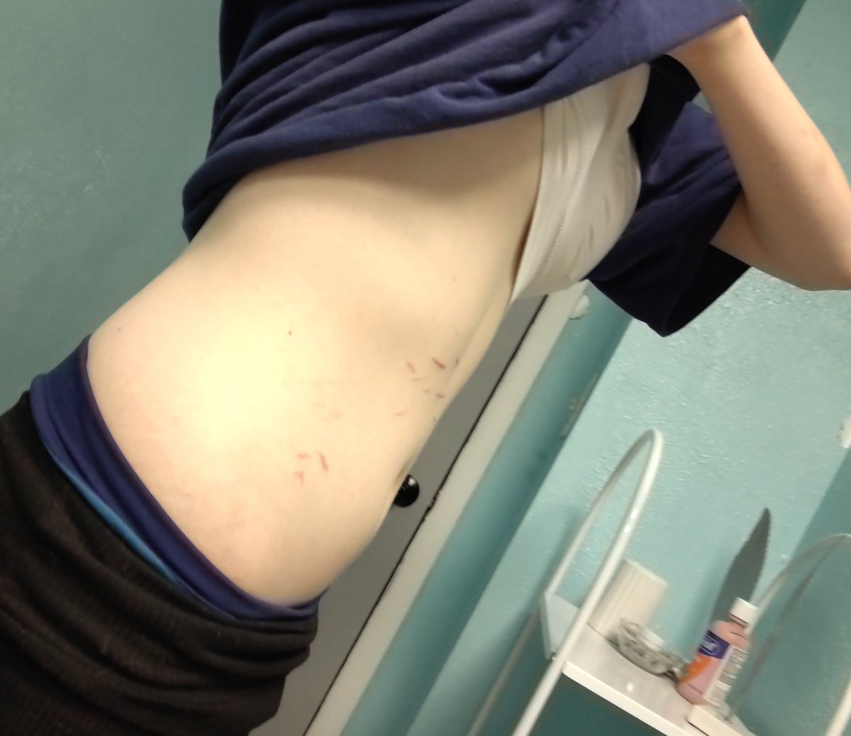 Fatal_angel488's tweet photo. #Ed #Edr-twt #moots  #moots #edtwt  #bodycheck 123.6lb today, Bmi 19.4 might be bloated, moot me up? https://t.co/qTUEJRbumB
