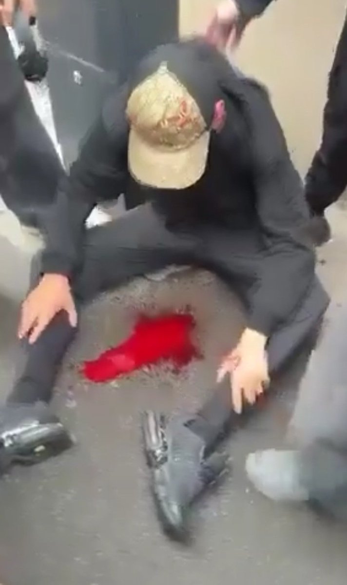 stevo3milliards's tweet photo. @NunezLaurent @Interieur_Gouv @education_gouv Juste équilibre ? Usage proportionné de la force ?
#Lycéens #ViolencesPolicieres @Defenseurdroits @SebLecornu https://t.co/7rj6Fdqkt9