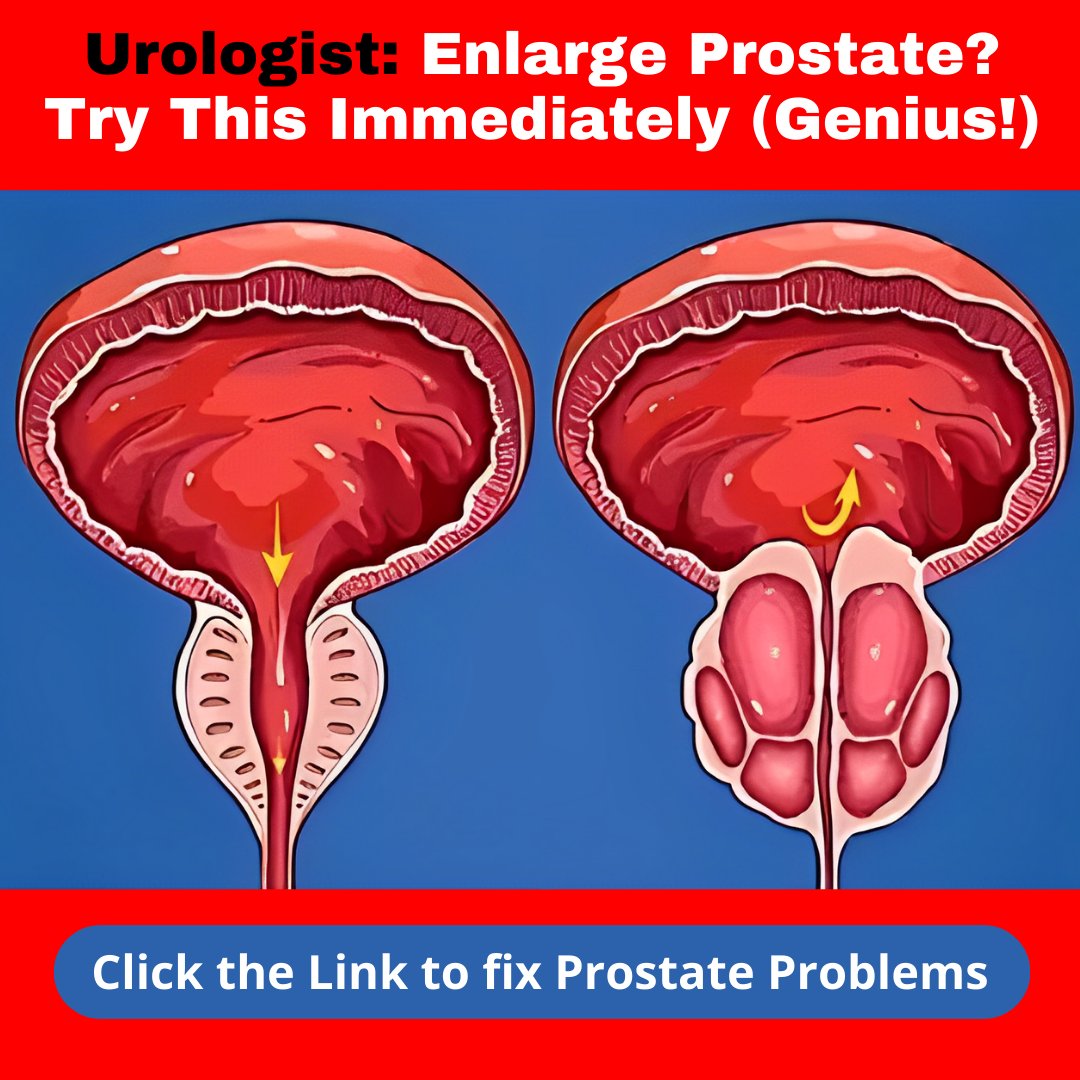 trade_2022's tweet photo. #prostate #prostatecancer #cancer #urology
#menshealth #health #prostatehealth #kidney
#urologia #prostata #men #endourology #over
Astronauts' Prostate Secrets Revealed! Watch
the Video to Learn To fix prostate problems.
👉 https://t.co/oLkUJWf9XD 👈 https://t.co/Z9z0d2gHvm