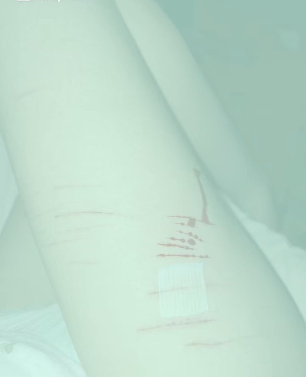 cryingunivorn's tweet photo. All fake! All sfx makeup with a fake skin layer for Halloween twitter!!

Just testing my new one out
#shedtwt #sharm #sh https://t.co/FMlQqJg3NQ