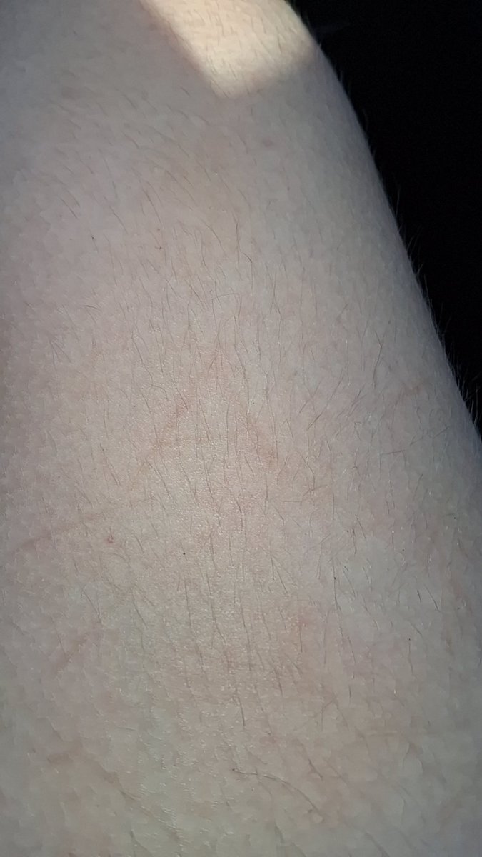 manicpanicpsych's tweet photo. Can any1 give me ideas on how to cover this? I really dont want to have to keep looking at my groomers initial 

#shtwt #shedtwt #kms https://t.co/CKZQKFPhjg