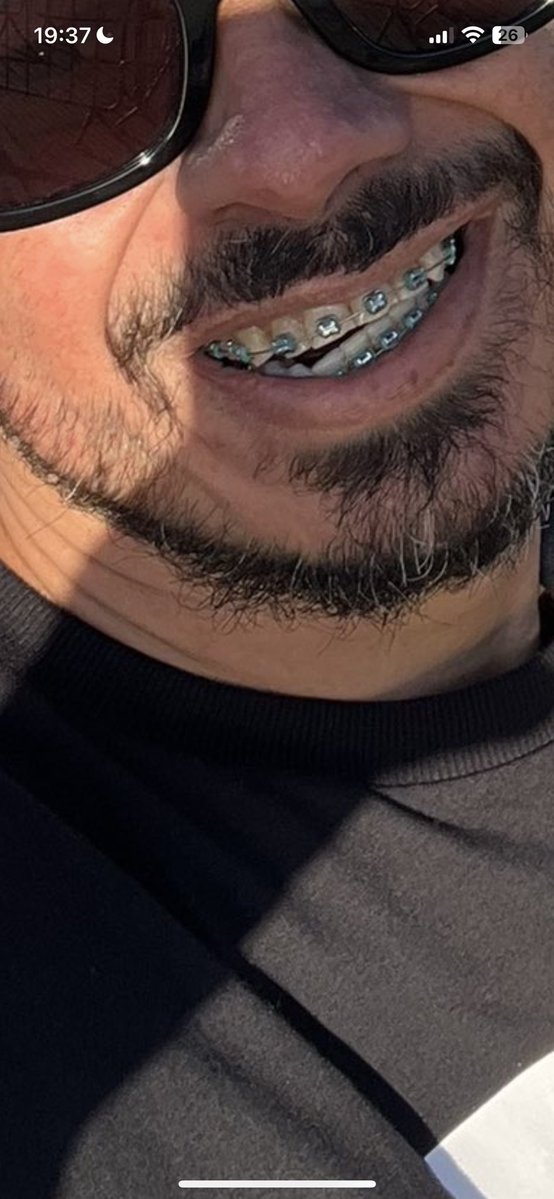 mktluque's tweet photo. @flaviogarag Tu do meu lado mulher nenhuma te olha 😂😂😂 seu cracudo dos dente podre https://t.co/AcwiYznXE4
