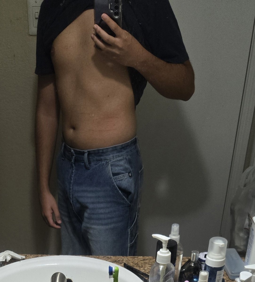 anomalicel's tweet photo. Hi im new to #edrtwt / #shedtwt / #shedrtwt 
Pls moot up im looking for more moots to be friends with and share goals/progress
Cw: 150lbs
Gw:120-125lbs
I am not toxic rlly anyone is cool https://t.co/L0LQyICLVh
