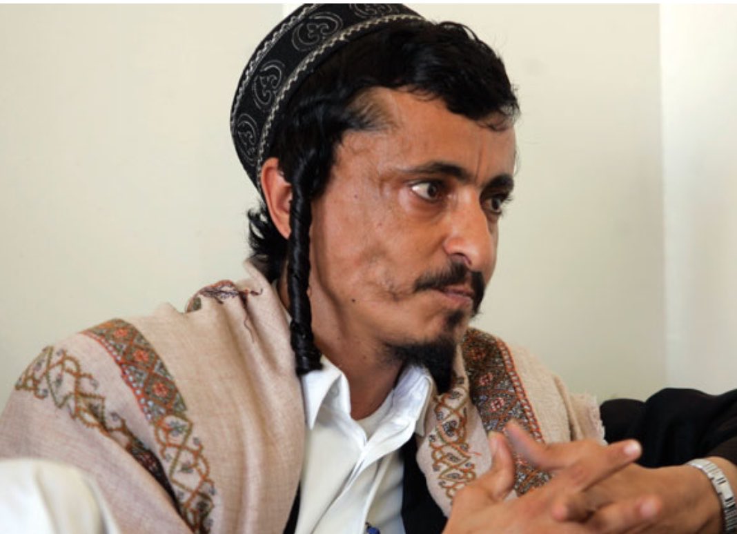 galligatano's tweet photo. Levi Salem Musa Marhabi est l’un des derniers Juifs qui vit encore au Yémen.

Il est retenu en otage par les terroristes houthis depuis 10 ans.

@amnesty n’a jamais appelé à sa libération.

@lemondefr, @humanite_fr, @Mediapart ou @libe n’ont jamais évoqué son calvaire.

(1/2) https://t.co/Gi7DlK2qGk