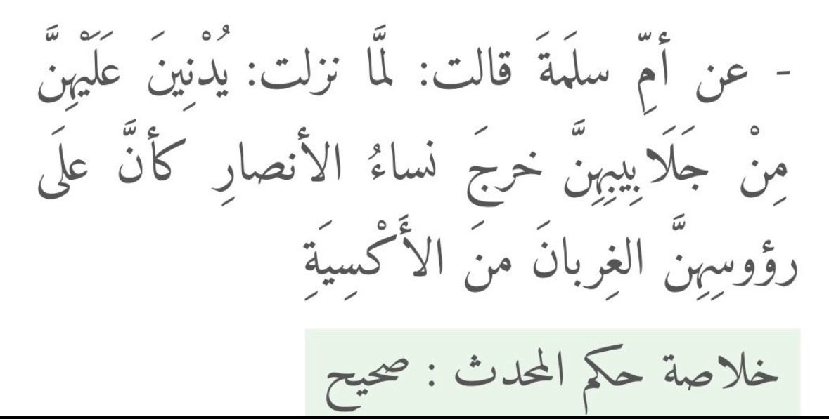 Xh7cii's tweet photo. @ALSANAD_MESHARI دام انه فيه تخصيص بازالته في الايام الحرم فهذا يعني انه كان بالاساس يلبسونه https://t.co/1zrM3VJXip