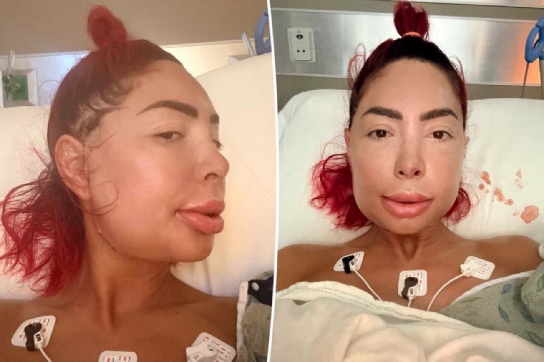 via @Mayor_of_dallas Farrah Abraham new look after jaw surgery