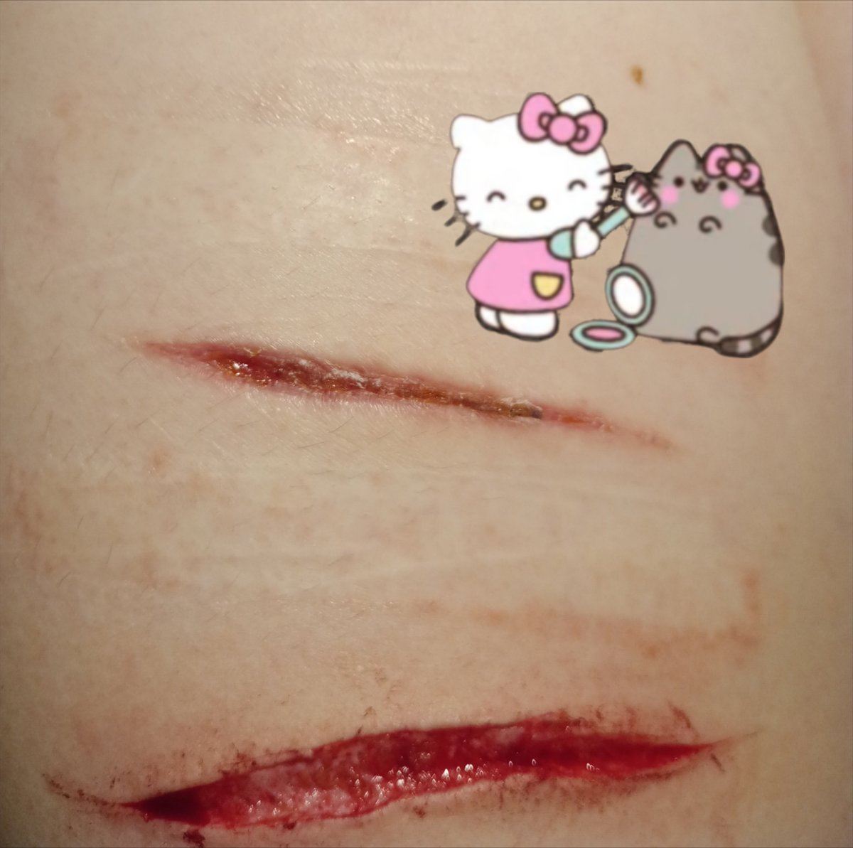 czerniak_first's tweet photo. Improved my SFXmake-up skills a bit

!All fake hyperrealistic, special effects, 
AI enxhanced make-up!

[Tw: fake blood] https://t.co/BqtPh3GvLR