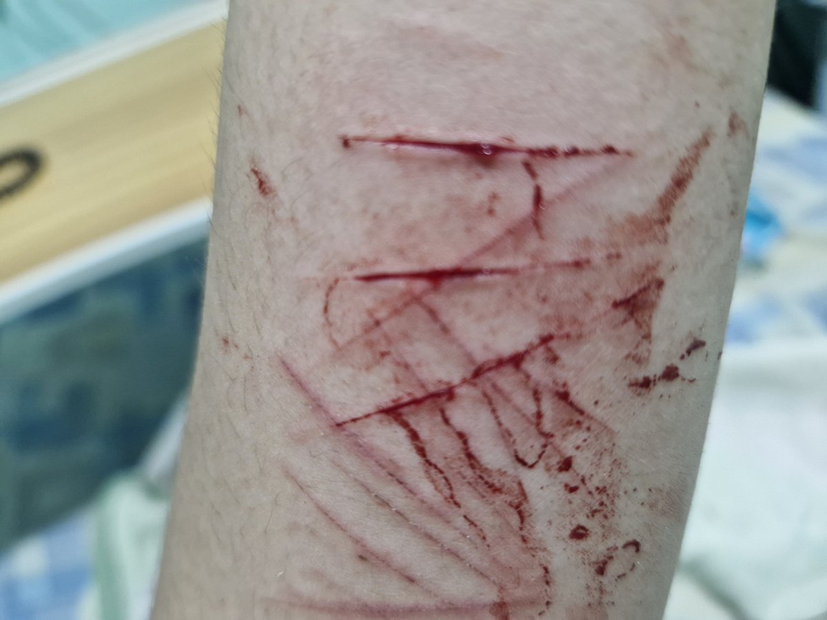 riyunnieee's tweet photo. can someone tell me if these are baby styros? I saw white before they took a while to bleed. 

FAKE HALLOWEEN MAKEUP !! ^_^

#slittwt #shtwt #shhtwt https://t.co/BNWIjbH3Ph