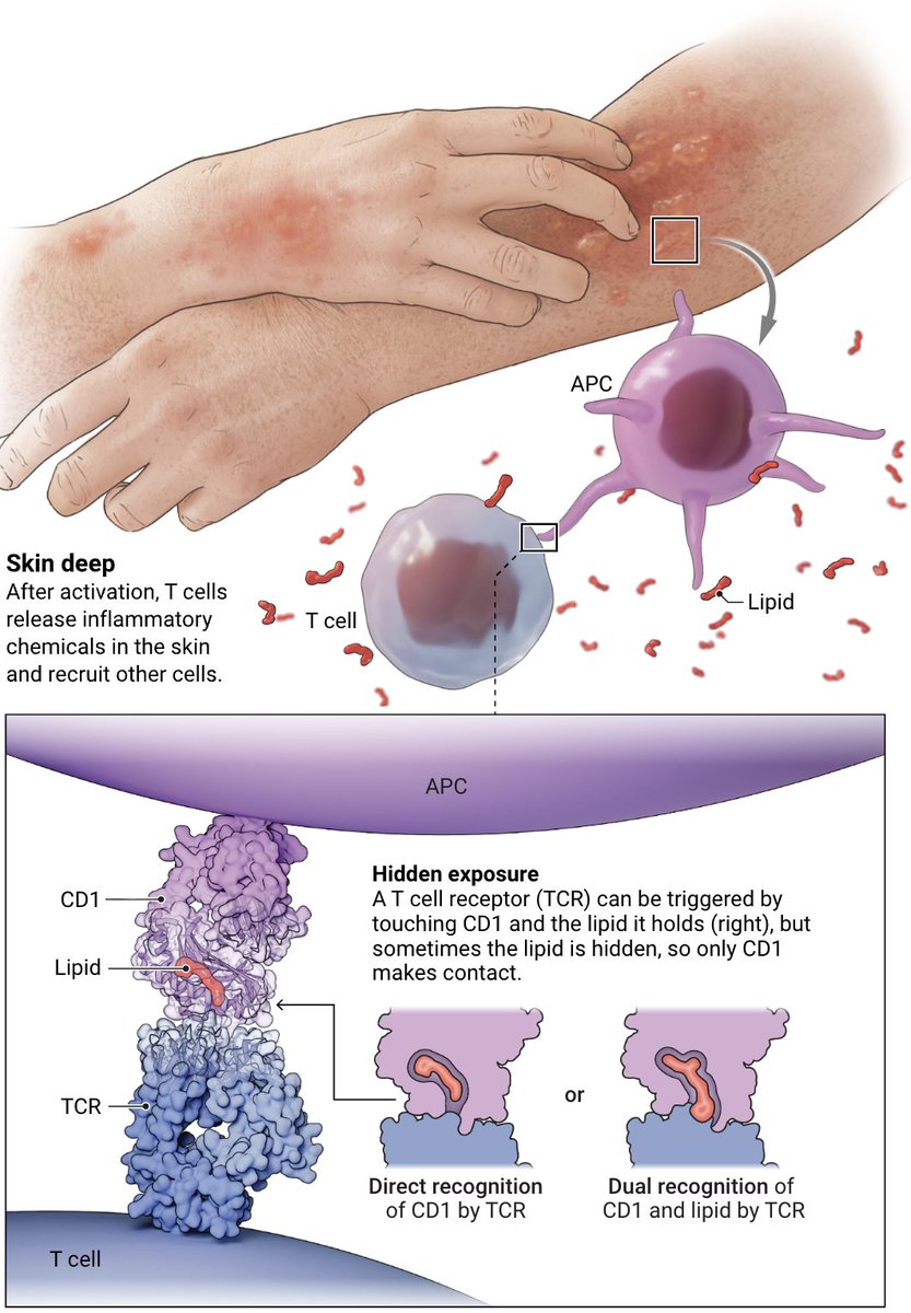 ScienceMagazine's tweet photo. CD1 proteins on so-called antigen-presenting cells display lipids from pathogens to T cells to drive protective immune responses, but they also trigger skin inflammation in response to some lipids.

Learn more: https://t.co/c6l9t14uBR @NewsfromScience https://t.co/aw82zgmqZq