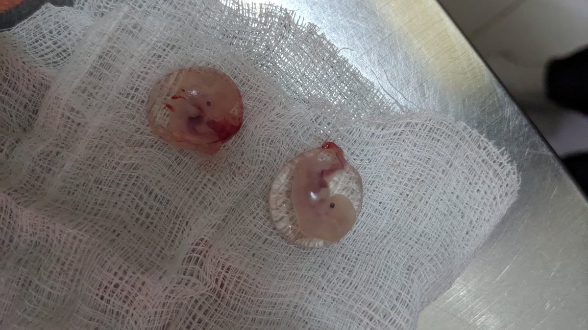 elvine__'s tweet photo. Two early embryos in their sacs after an abortion . https://t.co/6B3r1iDNDA