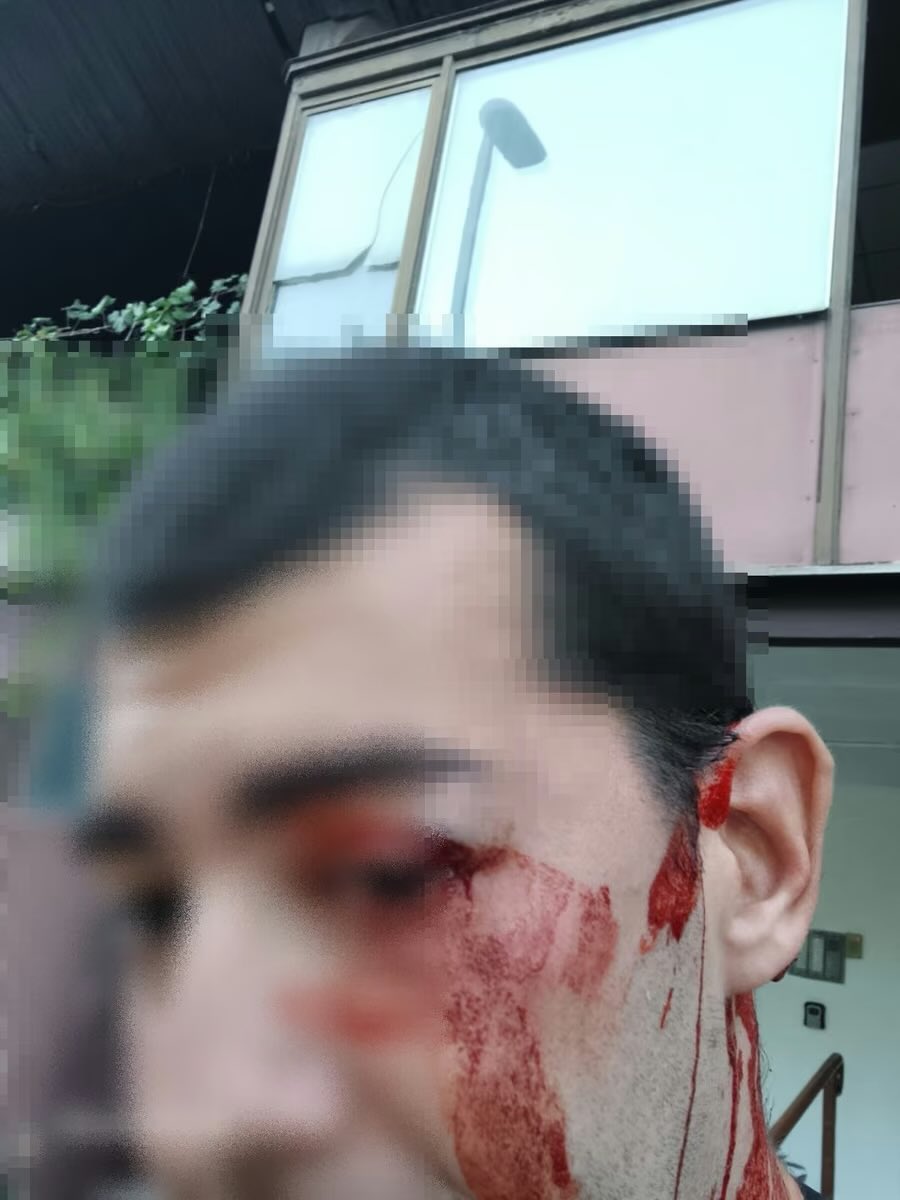 stimac15's tweet photo. Je l’ ovo ta vaša „nenasilna kampanja“ o kojoj danima pričate?! Čovek iz Agencije za sprečavanje korupcije se uredno legitimisao, došao da fotografiše vaš SNS štand u Bloku 19 i dobio batine i završio na VMA! A onda vi danima pričate kako su studenti i ljudi koji podržavaju Studentsku listu nasilnici?! Pa ko je ovde lud?! Nemojte više nikome da držite lekcije o nasilju dok vam čovek koji je došao da radi svoj posao ne završi u bolnici zbog vašeg štanda. Jer kad čovek dođe da radi svoj posao, legitimiše se i bude prebijen zato što je fotografisao vaš štand, onda više nije pitanje šta vi pričate, nego šta ste vi napravili od ove zemlje. I zato, pre nego što sledeći put izgovorite reč „nasilje“, pogledajte se u ogledalo. Tamo vam je odgovor. 
Zato 25. oktobra glsamo za 3 da se ovakve stvari više nikad ne dešavaju!
Studenti pobeđuju