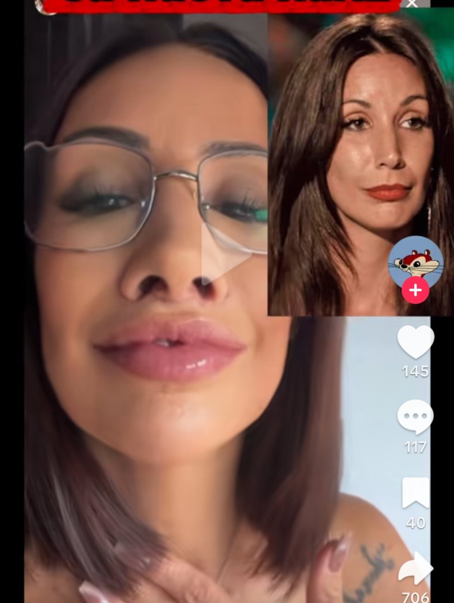 SaraMalaFan's tweet photo. A nadie le importa la rinoplastia de Borja estando ELLA https://t.co/qGWuDT9eSr