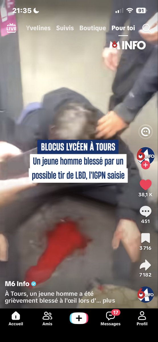 CXW_ZEN's tweet photo. Un policier qui crève l’œil d’un lycéen, un autre qui se fais casser les dents  avec une grenade fumigène pour un blocus et ils attaquent même les pompiers qui nous protègent et personne ne se révolte ? Faudrais penser à recommencer les émeutes  #blocus #police #bavure https://t.co/ZOL06wbqpA
