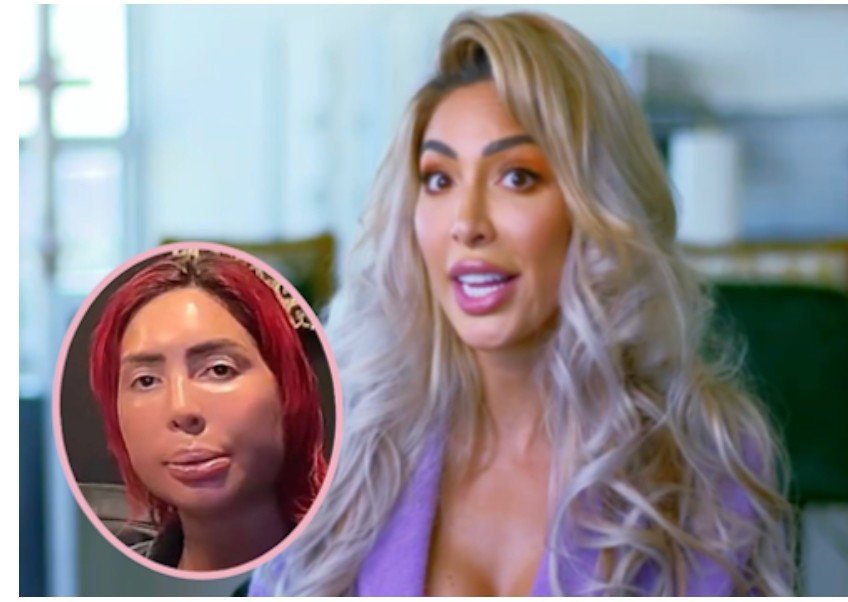 Farrah Abraham jaw wired shut Farrah Abraham mouth wired shut recovery