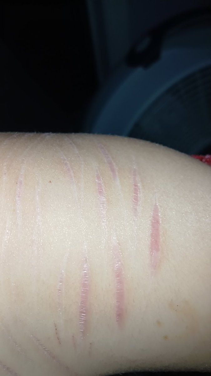 juneg_016's tweet photo. #slittwt #aisfxmakeup #goretwt all Ai. Bb beans fresh plus healed. https://t.co/Gnkt3D4YI1