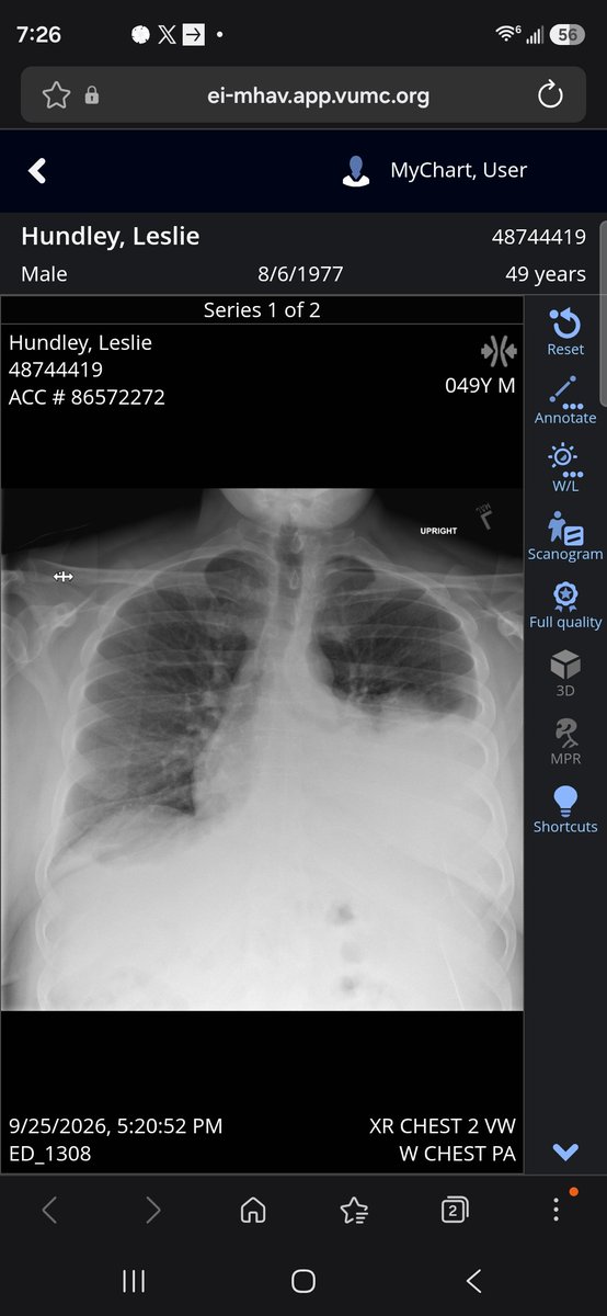djtonyh's tweet photo. The last 5 days I've learned the true definition of the haves and haves not. I've been battling cirrhosis of the liver since Apr. of 26 and in need of a Liver TP, but since I'm uninsured and have no money @VUMChealth ran useless test and basically said good luck with condition. https://t.co/KoqrR4psJH